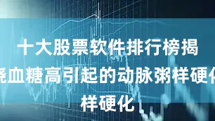 十大股票软件排行榜揭晓血糖高引起的动脉粥样硬化